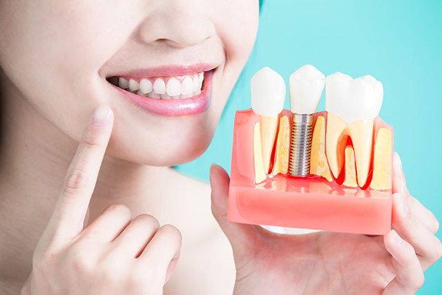 cons of dental implant
