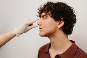 bulbous nose rhinoplasty procedure